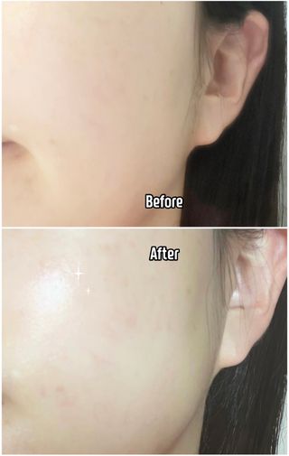 MF[스킨1004] 마다가스카르 센텔라 앰플 100ml — 5점을 준 리뷰어가 2024년 5월 올린 사용 사진