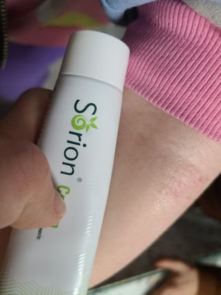 건선/아토/습진/민감성 피부 천연보습진정크림 소리온 크림 & 센시티브 크림 50g — 5점을 준 리뷰어가 2022년 2월 올린 사용 사진