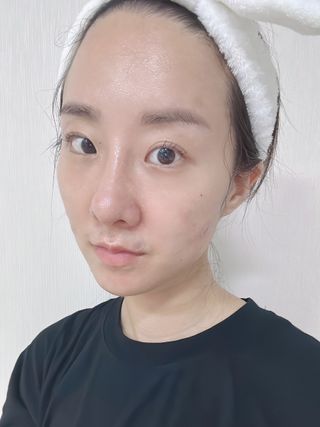 세뚜아(Cettua) 세뚜아 스팟 클리어 듀얼 패치 Cettua Spot Clear Dual Patch — 5점을 준 리뷰어가 2023년 8월 올린 사용 사진