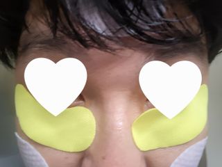 세뚜아(Cettua) [세뚜아] 비타풀 아이 패치 Cettua Vita-Full Eye Patch — 5점을 준 리뷰어가 2024년 2월 올린 사용 사진
