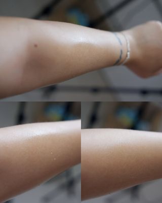 [후르디아] 등드름 잡는 바디 미스트 2개 세트 — 5점을 준 리뷰어가 2021년 7월 올린 사용 사진