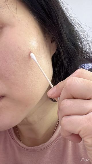 작심연구소 바르는 피부과 레이저 메디스팟크림 플러스 — 4점을 준 리뷰어가 2022년 5월 올린 사용 사진