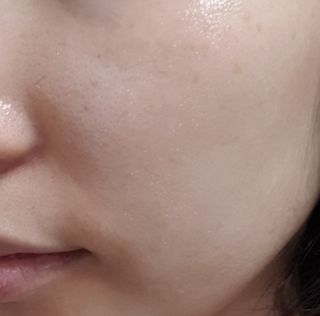 냉장고에 넣어요, 붉은 트러블 피부 다음날 진정되요 [버진팜스 푸딩수딩아토] — 5점을 준 리뷰어가 2021년 9월 올린 사용 사진