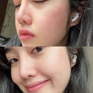 랑벨 랑바이오 블랙 시카 퀵 패드 100매 (3초 쿨링/3분 흡수, 블랙비 프로폴리스/시카 4종 함유, 대용량) — 5점을 준 리뷰어가 2022년 3월 올린 사용 사진