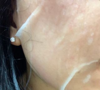 Dr.느루벗 느루벗 EGF FGF 스킨 리커버리 마스크 10장 — 5점을 준 리뷰어가 2021년 5월 올린 사용 사진