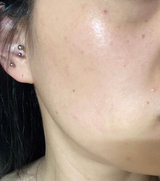 리더스코스메틱 리더스 카밍 바이오틱스 에센스 워터 — 5점을 준 리뷰어가 2021년 4월 올린 사용 사진