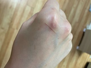 [큐어반H 커팅] 간편하게 떼서 쓰는 자외선차단 습윤밴드 (1팩/30매입) — 5점을 준 리뷰어가 2022년 12월 올린 사용 사진
