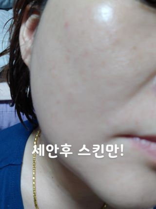 브에노 스킨셀 더마 앰플 — 5점을 준 리뷰어가 2021년 6월 올린 사용 사진