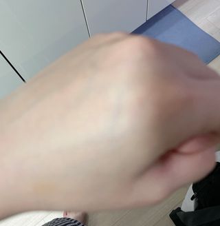 건선/아토/습진/민감성 피부 천연보습진정크림 소리온 크림 & 센시티브 크림 50g — 5점을 준 리뷰어가 2022년 1월 올린 사용 사진