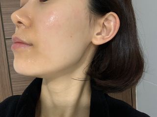 태그스킨 4스텝 주름개선 피부미백 영양 마스크팩 3개 세트(최신버전) — 5점을 준 리뷰어가 2022년 3월 올린 사용 사진
