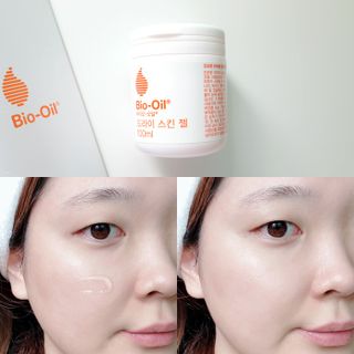 바이오오일 [바이오-오일] 드라이 스킨 젤 100ml — 5점을 준 리뷰어가 2021년 9월 올린 사용 사진
