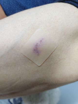 [큐어반H 커팅] 간편하게 떼서 쓰는 자외선차단 습윤밴드 (1팩/30매입) — 4점을 준 리뷰어가 2022년 11월 올린 사용 사진