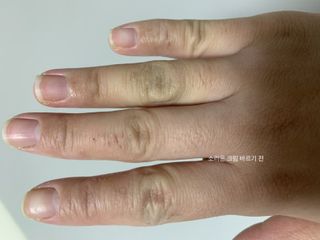 건선/아토/습진/민감성 피부 천연보습진정크림 소리온 크림 & 센시티브 크림 50g — 5점을 준 리뷰어가 2022년 1월 올린 사용 사진