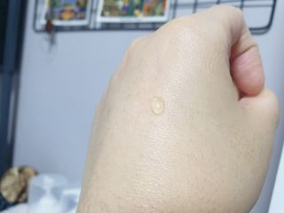 히루스카 포스트아크네 클리어 — 5점을 준 리뷰어가 2021년 1월 올린 사용 사진