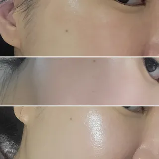 태그스킨 4스텝 주름개선 피부미백 영양 마스크팩 3개 세트(최신버전) — 5점을 준 리뷰어가 2022년 3월 올린 사용 사진