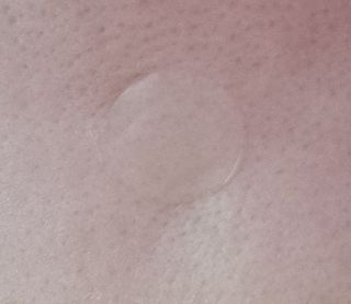 올리브영 엘라밴드 하이드로 도트 스팟패치 12mm, 티트리 — 5점을 준 리뷰어가 2022년 10월 올린 사용 사진