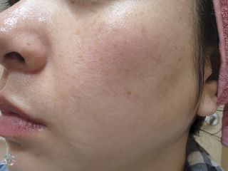 올인원 피부관리 이야 갈바닉 마사지기 — 5점을 준 리뷰어가 2023년 3월 올린 사용 사진