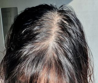 MOAMANEMUNAH 모아만에무나 플러스 두피 탈모 완화 기능성 샴푸 + 브러쉬 2종 세트 — 4점을 준 리뷰어가 2021년 10월 올린 사용 사진