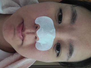 세뚜아(Cettua) 세뚜아 스티키 포어 패치 Cettua Sticky Pore Patch — 5점을 준 리뷰어가 2023년 8월 올린 사용 사진