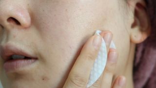 팜스테이 티트리 바이옴 카밍 토너 패드 — 5점을 준 리뷰어가 2022년 7월 올린 사용 사진
