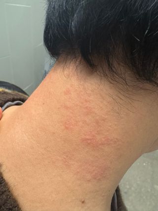 나우 [리브엠] 화해 1등 수분앰플 , 엑소코어 워터풀 텐션 앰플 — 5점을 준 리뷰어가 2024년 11월 올린 사용 사진