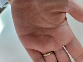 리더스코스메틱 리더스 퍼스트 샷 액티브 에센스 에이지 컨트롤 — 5점을 준 리뷰어가 2021년 11월 올린 사용 사진