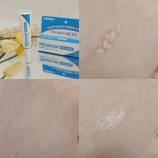 히루스카 포스트아크네 클리어 — 4점을 준 리뷰어가 2021년 2월 올린 사용 사진