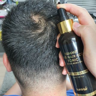 썸헤어 / SUMHAIR 썸헤어 써밋 안티 헤어로스 토닉 — 4.5점을 준 리뷰어가 2021년 6월 올린 사용 사진