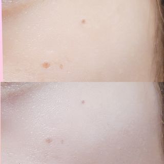 광동생활건강 MF[광동] 비타500✨주름개선·미백·SPF50+🌞퍼펙트쉴드 빅 선쿠션 본품 — 5점을 준 리뷰어가 2024년 5월 올린 사용 사진