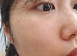 [큐어반H 스팟] 자외선 99프로 차단되는 스틱타입 스팟밴드(1팩 / 66매입) — 5점을 준 리뷰어가 2022년 11월 올린 사용 사진