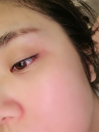 태그스킨 4스텝 주름개선 피부미백 영양 마스크팩 3개 세트(최신버전) — 5점을 준 리뷰어가 2022년 4월 올린 사용 사진