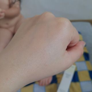젠바이오 코스메틱스 젠바이오수딩크림]   가려운 피부 & 아토피 원픽 크림 — 5점을 준 리뷰어가 2022년 7월 올린 사용 사진