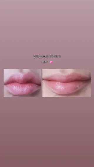 틱톡 [후르디아] 튼입술해결템 올리브영 블루베리 하이드레이팅 허니 립밤 — 5점을 준 리뷰어가 2024년 3월 올린 사용 사진