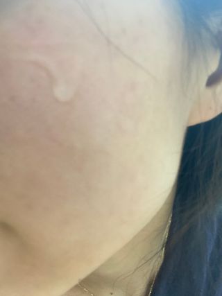 체르엠 스템앤셀 비타민 브라이트닝 에센스 30ml 1개 — 5점을 준 리뷰어가 2021년 9월 올린 사용 사진