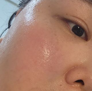 MF[스킨1004] 마다가스카르 센텔라 앰플 100ml — 5점을 준 리뷰어가 2024년 5월 올린 사용 사진