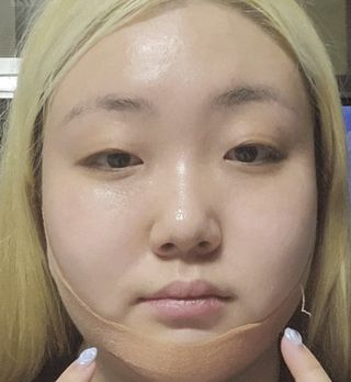 아이디플라코스메틱 아이디 페이스핏 마이너스 밴드 v2 — 5점을 준 리뷰어가 2022년 5월 올린 사용 사진