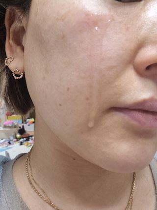 렉스리 닥터 올인원 세럼 Rexri Dr.All-in-one Serum — 5점을 준 리뷰어가 2022년 11월 올린 사용 사진