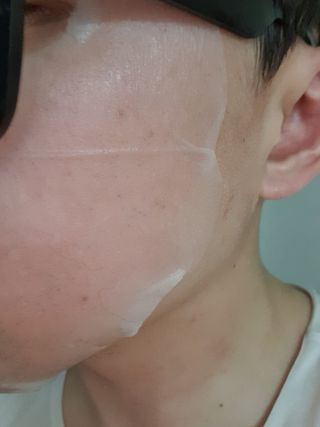 아미퓨어 촉촉하고 밝은 피부를 만들어주는 1일1팩, 아미노이펙트 마스크 10매 — 5점을 준 리뷰어가 2021년 7월 올린 사용 사진