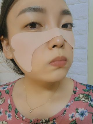 건강누리인터내셔날 닐 하이드로겔 스킨 프로텍터 골프패치 [1BOX=5매입] — 3점을 준 리뷰어가 2022년 5월 올린 사용 사진