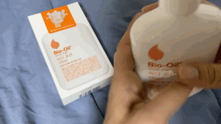 바이오오일 [바이오-오일] 바디 로션 175ml — 5점을 준 리뷰어가 2021년 11월 올린 사용 사진