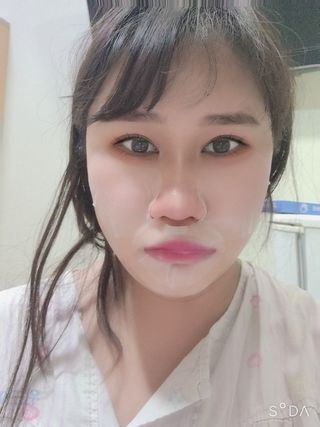 리더스코스메틱 리더스 카밍 바이오틱스 퀵 수딩 패드 — 5점을 준 리뷰어가 2022년 4월 올린 사용 사진