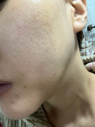 [후르디아] 아보카도 비건 약산성 효소필링젤 — 5점을 준 리뷰어가 2024년 2월 올린 사용 사진