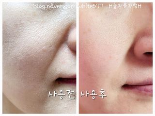 나우 [리브엠] 화해 1등 클렌징 파우더! 모공&피지 말끔순삭 — 5점을 준 리뷰어가 2025년 5월 올린 사용 사진
