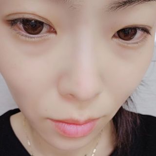 세뚜아(Cettua) 세뚜아 스팟 클리어 듀얼 패치 Cettua Spot Clear Dual Patch — 5점을 준 리뷰어가 2023년 11월 올린 사용 사진