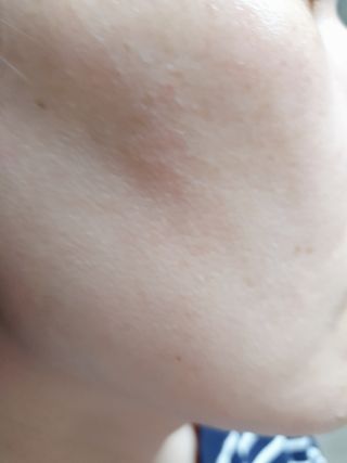 아이디플라코스메틱 아이디 브이로직 마이너스 필링 토너 110ml — 5점을 준 리뷰어가 2022년 1월 올린 사용 사진