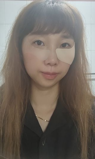 원에이드 알로에사포나리아 투명 골프패치 & 원에이드 하이드로겔 스포츠패치 — 5점을 준 리뷰어가 2022년 8월 올린 사용 사진