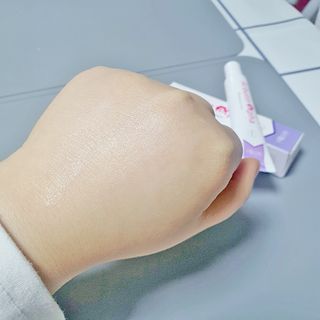이엔코스 알부틴 알파 화이트닝크림 — 5점을 준 리뷰어가 2021년 3월 올린 사용 사진