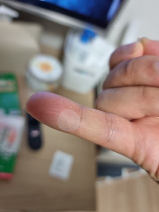[큐어반H 스팟] 자외선 99프로 차단되는 스틱타입 스팟밴드(1팩 / 66매입) — 5점을 준 리뷰어가 2022년 11월 올린 사용 사진