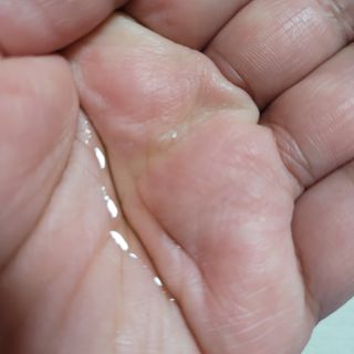 바이오오일 [바이오-오일] 스킨케어 오일 내추럴 60ml — 5점을 준 리뷰어가 2021년 5월 올린 사용 사진