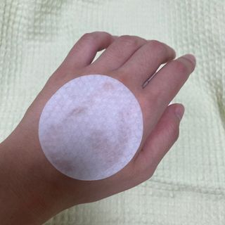 키노닉스 양배추 카밍 진정 토너패드 — 3.5점을 준 리뷰어가 2021년 7월 올린 사용 사진